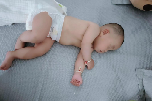 三门峡六个月宝宝眼睛散光
